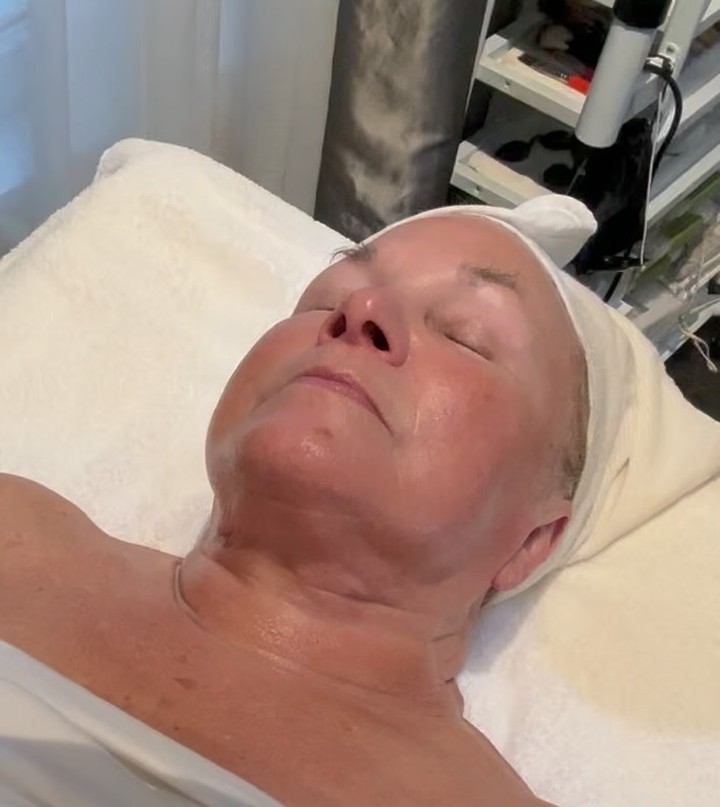 My Advanced Liquid Microneedling Treatment aka Special Spicules 🩷#advancedkoreanskincare #koreanskincare #exosomes