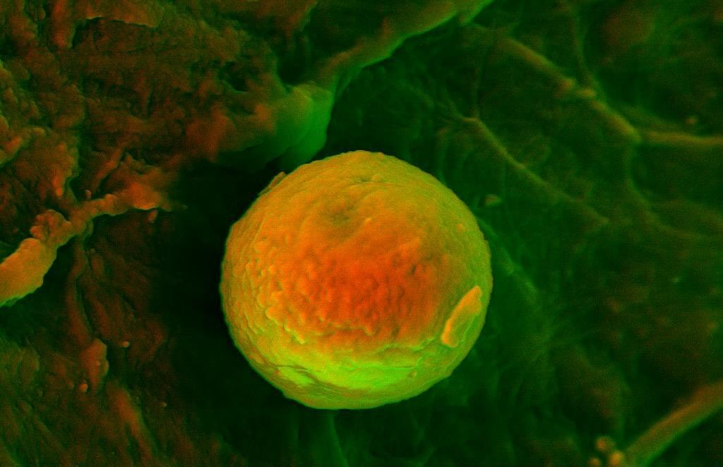 Cardiac calcification
#science #electronmicroscope #laboratory #scienceart #sciencephoto #scientific #scienceweek #research #lab #micro #microscope #microscopy #medicine #medicalsciencestudent #medicalstudent #macrophotography #mineralomics #bio #biology #bioimaging #biologylab #minerals #chemistry #material #engineering #physics #sciencecommunication #ucl #DDCSEM #Mineralomics