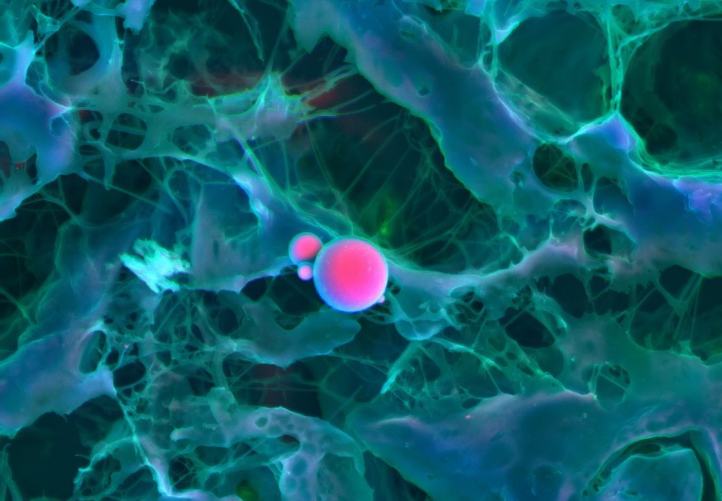 Cardiac calcification #science #electronmicroscope #laboratory #scienceart #sciencephoto #scientific #scienceweek #research #lab #micro #microscope #microscopy #medicine #medicalsciencestudent #medicalstudent #macrophotography #mineralomics #bio #biology #bioimaging #biologylab #minerals #chemistry #material #engineering #physics #sciencecommunication #ucl #DDCSEM #Mineralomics