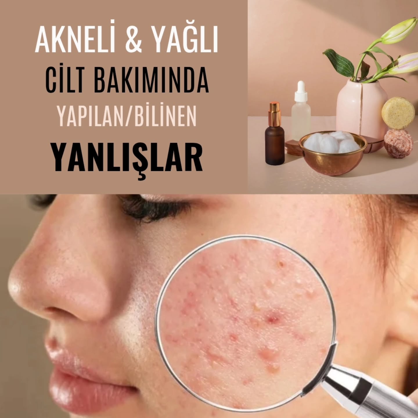 Haydi bakalım, hata yapın da görelim:)
Yine de çok önemli bir şeyi hatırlatmayı unutmuşuz, onu da buraya ekleyelim:
Yediğimiz içtiğimiz besinlere dikkat etmediğimiz sürece de, bozuk bir cilde sahip olmamız kaçınılmaz olacaktır🥲
Paketlenmiş her türlü gıda
Kısıtlı sebze tüketimi
Az su tüketimi
Abur cuburlar, çikolatalar, şekerler, yağlı, çok baharatlı, işlenmiş gıdalar
Sigara, alkol tüketimi
...
Yağlı cilde sahip olanlara göndermeyi, beğenmeyi ve kaydetmeyi unutmayın 🥰
#purlennatura
#doğalciltbakımı #aknelicilt #akneliciltbakımı #sebumcontrol #sebumdengeleme #sebumdengeleyici #yağlıcilt #yağlıciltbakımı #yaglicilt #doğalkozmetik #temiziçeriklikozmetik