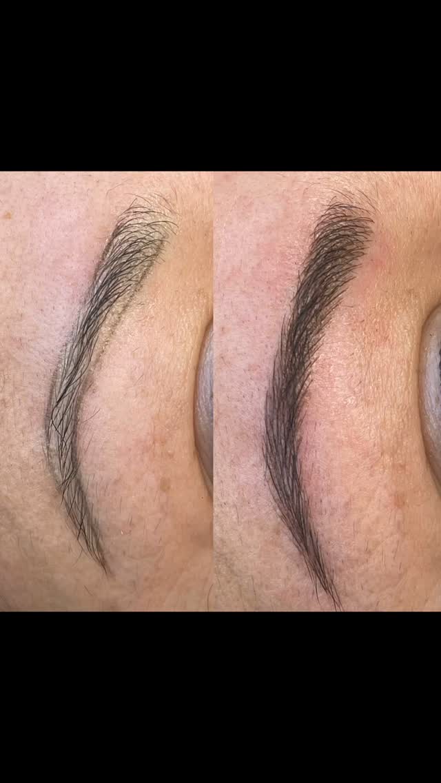 ✨ Before & After Magic! ✨ Just wrapped up an incredible session with my lovely client, and her satisfaction with her freshly microbladed brows is through the roof! 🥰 These beauties will last 24/7, giving her that perfect look every day!
Here are three reasons why microblading is a game-changer for those with thinning eyebrows:
1. **Natural Appearance**: Microblading creates realistic, hair-like strokes, making it look like you were born with perfectly full brows. Say goodbye to harsh lines and hello to a natural finish!
2. **Time-Saving**: With microbladed brows, you can cut your makeup routine in half! No more filling in your brows every morning—just wake up and go!
3. **Long-Lasting Results**: Enjoy beautiful brows that last for up to 1-3 years, depending on your skin type and aftercare. It’s a hassle-free solution for everyday glamour!
Ready to transform your brows? Let’s chat! 💖 #Microblading #BrowGoals #BeautyTransformation