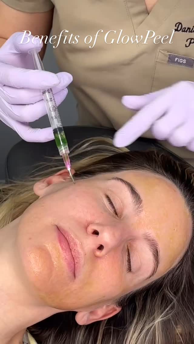 She really is THAT girl✨ A low downtime treatment where you walk out with show-stopping skin, and get subtle exfoliation that follows.
GlowPeel is safe for all skin types, is quick, and can be done to address all skin concerns on face and body.