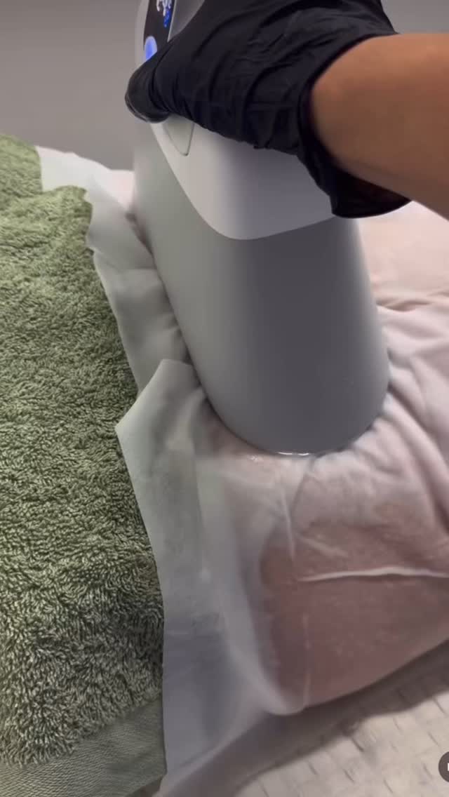 Everyone is talking about the new CoolSlimming Ultimate 360ยฐ machine, itโs the most advanced fat freezing machine available to date!
This machine has brand new upgraded technology with 13 Medical Grade Covered Silicone Grip Applicators for every area at every angle. There is no other machine on the market to rival it!
Here are the reasons why:
๐ 13 Covered Silicone Grip Applicators for Any Area
๐ Fast and Easy Applicator Exchange
๐ Any Treatment Area at Any Angle
๐ Anti Bruise Technology
๐ Silent Mode (much quieter than previous models)
๐ Upgraded 360ยฐ Surround Cooling angle
๐ 300% Increased Coverage with selected applicators
๐ Treat 4 Areas At The Same Time
๐ Up to 40% Fat Reduction Per Treatment
๐ Smart Pre Set technology
๐ One button touch start (no need to stabilise treatments anymore)
Trade in your old CoolSlimming Device and always keep up to date with current technology and offer the best possible results to your clients.
Contact us for more information ๐ฒ