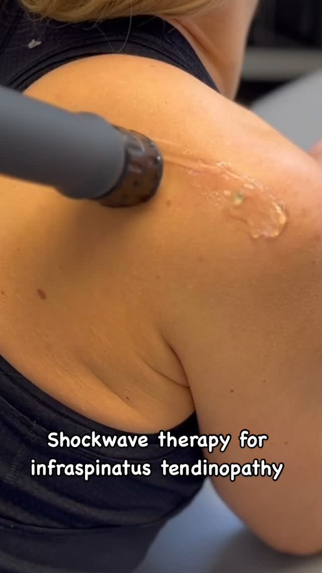 💥 Revolutionize Your Approach to Infraspinatus Tendinopathy 💥
Struggling with stubborn infraspinatus tendinopathy in your patients? 🎯 Shockwave therapy is a game-changing tool that, when combined with targeted rehab, delivers excellent outcomes.
In this video, we showcase shockwave therapy for infraspinatus tendinopathy, a key technique covered in our online course. Our step-by-step approach simplifies shockwave therapy application, helping healthcare professionals master it with confidence and precision.
📚 Ready to enhance your practice? Enroll now and take your treatment skills to the next level!
#ShockwaveTherapy #Physiotherapy #Infraspinatus #RotatorCuff #ShoulderRehab #SportsMedicine #Rehabilitation #PhysicalTherapy #OnlineLearning #HealthcareProfessionals #ShockwaveCourse #TherapySimplified