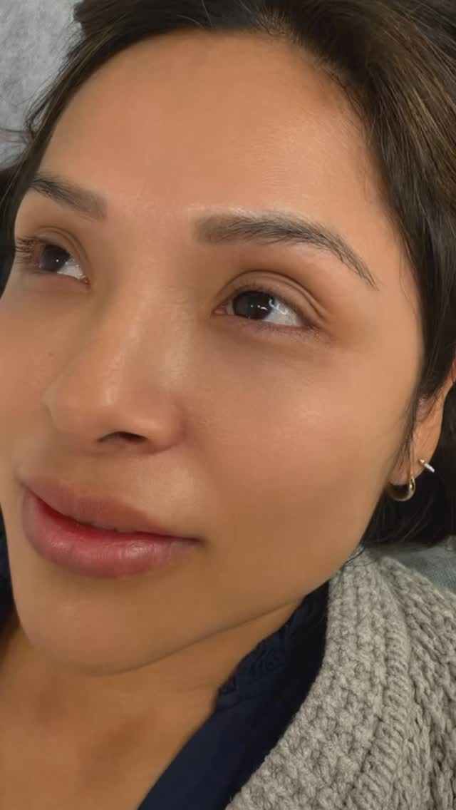 Applying eyeliner can be a daily challenge, often leading to uneven lines, smudging, and irritation. Factors such as unsteady hands, allergies to makeup products, and the time-consuming nature of achieving a precise look contribute to these struggles. 
Lash line enhancement offers a solution by depositing pigment along the lash line, creating the illusion of fuller, darker lashes without the need for daily application. This semi-permanent procedure provides a natural and defined appearance, saving time and reducing the frustration associated with traditional eyeliner. 
By opting for lash line enhancement, individuals can enjoy a consistently polished look, eliminating the common pain points of eyeliner application.
www.duniaghabour.com | 917-291-0588
.
.
.
.
.
.
.
.
.
.
.
.
.
.
.
.
.
.
.
.
.
.
.
.
.
.
.
.
.
.
.
#LashLineEnhancement #EyelinerStruggles #greenwichct #greenwichbeauty #BeautySolutions #PermanentMakeup #EffortlessBeauty
