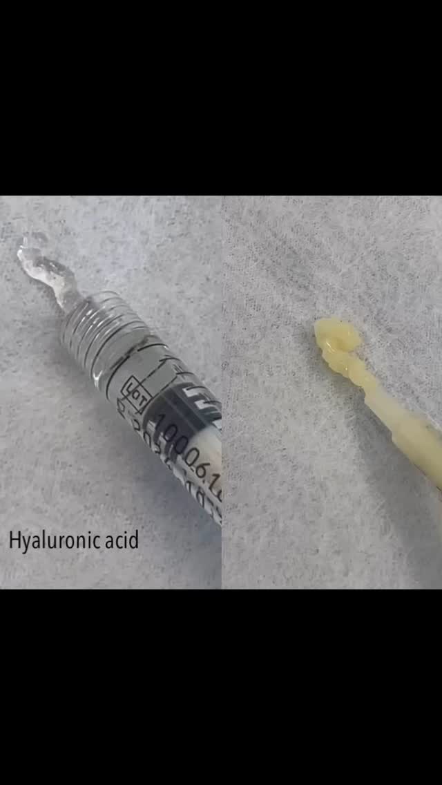 #PRFM Gel/Filler (Platelet Rich Fibrin Matrix) is an all-natural, autologous biostimulator and volumizing gel. This gel is obtained from your blood to improve skin tone and texture.
#HyaluronicAcid (HA) fillers are biocompatible and are effective in enhancing skin hydration, volume, and overall appearance.
Ready for the ultimate rejuvenation experience? 📞 239-777-5002 for a complimentary consultation.
.
.
.
#fillersnaples #medspanaples #medicalaestheticsnaples #injectablesnaples #medicalaestheticsnaples #rejuvinatingmedicine #antiaging
