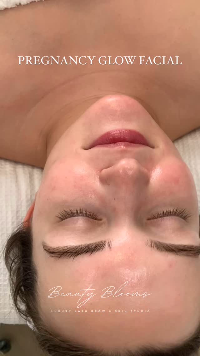 Our pregnancy facial glow is a skincare treatment designed to hydrate and nourish the skin during pregnancy. Pregnancy facials can help with dryness, hormonal breakouts, and puffiness.
This Glow facial is designed to be gentle on skin during pregnancy, this facial treatment incorporates nourishing products and only pregnancy-safe skincare products, ensuring a glowing, refreshed complexion without harmful ingredients. Perfect for pampering during pregnancy, this facial leaves your skin calm, radiant, and balanced.
Benefits
✨Hydration: Pregnancy facials can help with dryness, which is common during pregnancy.
✨Reduced puffiness: Facials can help reduce puffiness and water retention.
✨Improved circulation: Facials can increase blood flow, which can give the skin a healthy glow.
✨Reduced redness: Facials can help reduce redness caused by hormonal changes.
✨Stress relief: Facials can provide a soothing experience that can help ease stress
What to expect
✨Customizable: Facials can be customized to your skin type and concerns.
✨Safe ingredients: Facials can use ingredients that are safe for pregnancy, such as plant-based oils.
✨Gentle exfoliation like dermaplaning: Facials can gently remove dead skin cells without harmful chemicals.
What to consider
✨Avoid products that contain retin-A, retinol, hydroquinone, and other harmful chemicals.
✨Let the aesthetician know that you’re pregnant so they can make any necessary modifications.
#pregnancyfacialglow #glassfacial #facialcare #facial #beautybloomstudio #steinbachlashes #lashextensions #lashsalonsteinbach #brows #dermaplaningfacial #dermaplaningpro