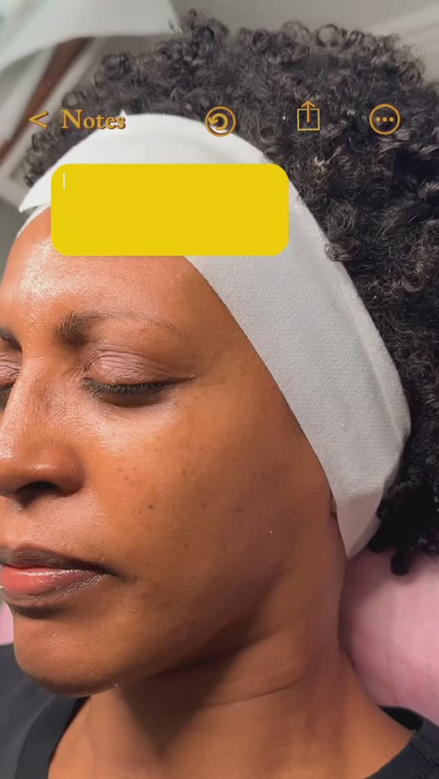 Transform Your Skin & Confidence ✨
The Ultimate Skin House Glow Experience!
☎️ (916)915-4004
Www.Skinhouse916.com
#facial #sacramento #skincare #acne #skin #esthetician #