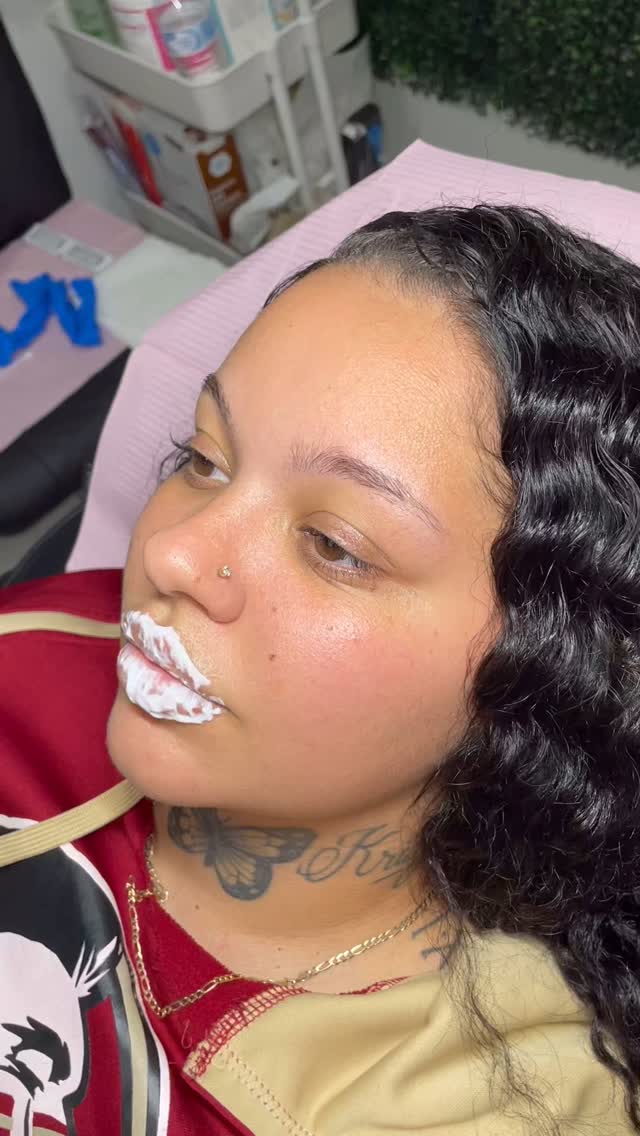 Doll lips on a doll 😍 #hyaluronpen #lipfiller #tampalips #microneedling #lipinjections #sarasota #stpete