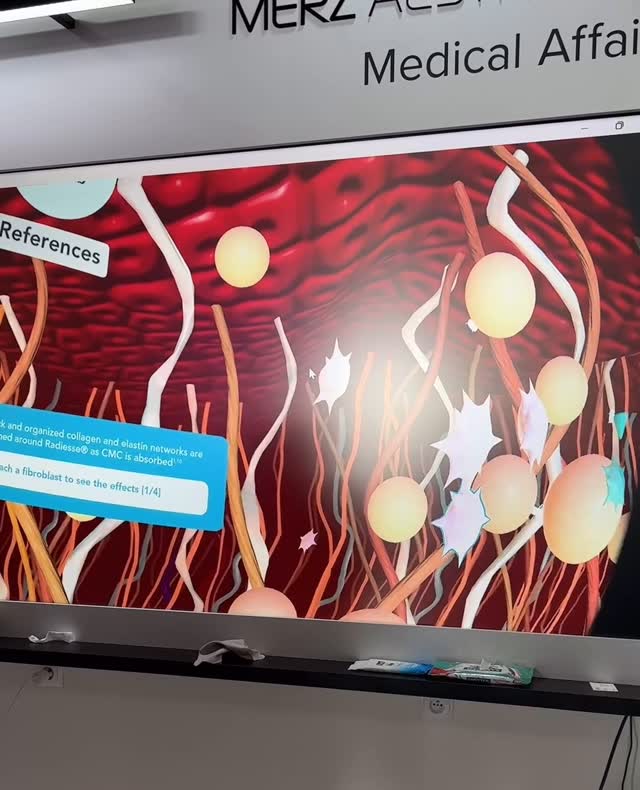 Follow me to have a look of our skin From inside! #huidverzorging #huidtherapie #gemeentpelt