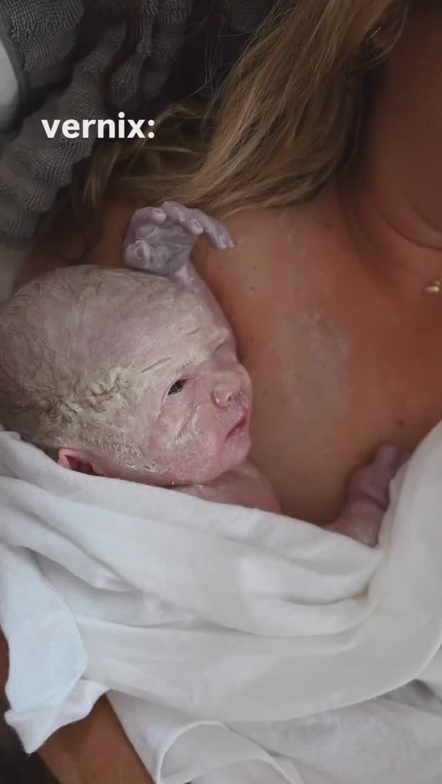 🎥 : @monetnicolebirths
Leave it on!
The aggressive stimulation and over wiping of a healthy baby is unnecessary and harmful.
Babies come out with what they need. Trust them.
𝐀𝐥𝐰𝐚𝐲𝐬 𝐫𝐞𝐦𝐞𝐦𝐛𝐞𝐫: 𝐁𝐢𝐫𝐭𝐡 𝐦𝐚𝐭𝐭𝐞𝐫𝐬. 𝐒𝐨 𝐝𝐨 𝐲𝐨𝐮. 💖, @doula.heather.taylor
#Homebirth
#intuitivebirth
#naturalbirth
#empoweredbirth
#birthwithoutfear
#gentlebirth
#positivebirth
#birthmatters
#birthworker
#homebirthisbest