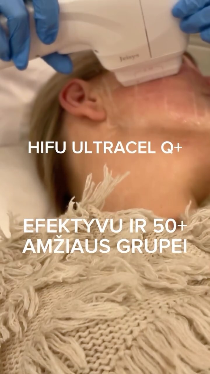 💎 HIFU Ultracel Q+ – jaunystės paslaptis be operacijos! 💎
Ar svajojate apie stangresnę, jaunatviškesnę odą, bet norite išvengti chirurgijos? HIFU Ultracel Q+ – tai pats naujausias ir pažangiausias neinvazinis odos patempimo sprendimas, kuris užtikrina ilgalaikius rezultatus be skausmo ir gijimo laikotarpio.
✨ Kodėl rinktis HIFU Ultracel Q+ mūsų klinikoje?
✔️ Naujausias modelis: inovatyvi technologija, garantuojanti itin tikslų ir greitą veikimą.
✔️ Natūralūs rezultatai: sužadina kolageno gamybą, restruktūrizuoja odą ir atjaunina jos struktūrą.
✔️ Galingas, bet švelnus: individualiai pritaikytų parametrų šūviai užtikrina komfortą procedūros metu.
✔️ Platus pritaikymas: veido, kaklo, dekoltė ir net kūno stangrinimas.
✔️ Ilgalaikis poveikis: rezultatai, kurie išlieka iki 2 metų.
💬 Klientų atsiliepimai:
„Procedūra labai veiksminga, o rezultatai matomi jau po pirmo karto!“
„Palyginus su kitais aparatais – Ultracel Q+ tiesiog nepalyginamai geresnis. Oda stangresnė, raukšlės sumažėjo!“
„Pirmas įspūdis – wow! Rekomenduoju visiems, kurie nori natūralaus atjauninimo.“
🎥 Pažiūrėkite, kaip atliekama ši inovatyvi procedūra, ir sužinokite, kaip ji gali pakeisti Jūsų odos būklę greitai ir efektyviai!
💥 Specialus pasiūlymas – rezervuok laiką jau dabar ir pasinaudok galiojančiomis NUOLAIDOMIS iki 50%.
📍 Adresas: Savanorių pr. 139, Kaunas “Ilgalaikio Grožio Klinika”.
📲 Registracija žinute arba telefonu: +37064700109
🔗 Rezultatus ir daugiau informacijos rasite čia:
https://www.ilgalaikiogrozioklinika.lt/hifu-odos-patempimas
#hifu #grozioproceduros #rauksliumazinimas #grozioklinika #stangrioda #ilgalaikisgrožis
#veidopatempimas