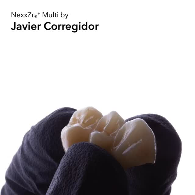 Welcome to the World of Sagemax Zirconia!
Discover stunning cases from around the globe.
Join us now and find the perfect zirconia disc to match your needs!
مرحبا بكم في عالم ساجيماكس للزركونيا!
اكتشف حالات مذهلة من جميع أنحاء العالم. انضم الينا الآن!
Learn more about our zirconia here: https:// sagemax.com/nexxzr-zirconia-portfolio/
@sagemax official
For more information on our products and for our latest promotions call us on
: 24513870 - 24513874
لمزيد من المعلومات و للاستعلام اتصل بنا : 24513870 - 24513874
#sagemax #dentalgoals #dentalzirconia #dentaldesigner #dentistryworld #dentallab #cadcamdentistry #odontolovers #dentallove #odontologica #zahntechnik #zirconiacrown #dentistryesthetics #cadcamlab #عيد_و_كبريته #زركونيا_ديسك #جودة_تثق_بها #جودة_عالية