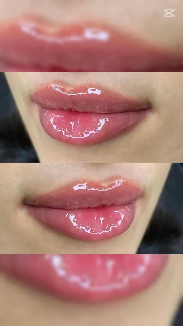 10% off all injectables until end of May!!!
Nurse Raisa specializes in all injectables but had built her popularity over the past few years with her gorgeous lip work 🙌🏼🙌🏼🙌🏼
Come check her out Wednesdays at Selfish Beauty Lounge!
✨✨✨✨✨✨✨✨✨✨✨
#lips #lipinjection #vaughanlips #vaughaninjector #botox #chininjections #dysport #injectorvaughan #woodbridgelips #woodbridgeinjectables #lipswoodbridge #beauty #skincare #beautytips #skinrejuvenation