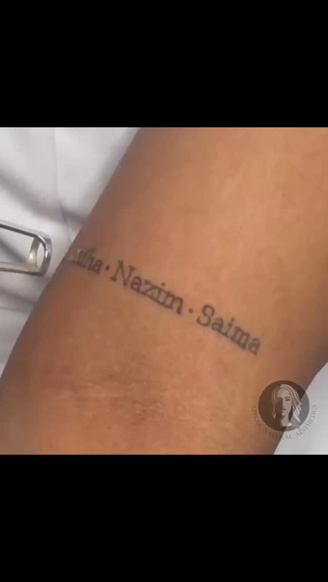 .
First session â
If you have some ink youâd like see the back of, get in touch to find out more about laser removal.
ð www.appearnaturalaesthetics.com
ð 07423 109237
ð§ info@appearnaturalaesthetics.com
ð· POA - from £45 per session
ðHayes, Bromley BR2 7EB
#tattooremovalsouthlondon #tattooremoval #tattooremovalspecialists #lasertattooremoval #tattooremovalkent #trusttheprocess #allwhitelaser