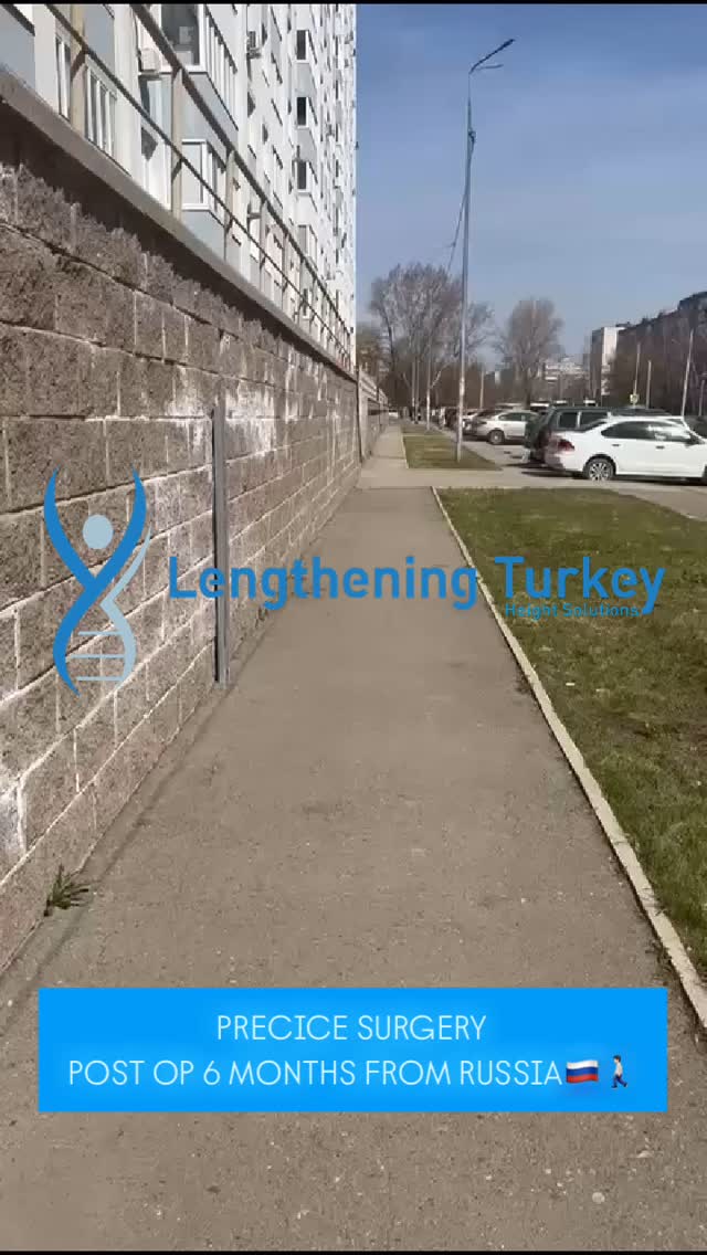 We’re excited to share the amazing progress of our patient from Russia 🇷🇺 who had PRECICE femur lengthening surgery just 6 months ago!
✅ Perfect bone formation
✅ Effortless walking without any help
✅ Pain-free & confident
Thanks to his dedication and our advanced care, he’s now living life at his new height with full mobility!
This journey is proof that with the right team and commitment, anything is possible!
Welcome to your new chapter ♂️✨
Informational/Educational only — not medical advice.
Evaluation & treatment are provided only by authorized healthcare facilities and the treating physicians.
#骨延長 #Beinverlängerung #腿延长
#limblengthening #leglengthening #heightextension #Quadrilateral #Precice #LON #LONsurgery #heightincrease #heightgrowth
#PreciceLengthening #HeightJourney #LegLengthening #PatientSuccess #LengtheningTurkey