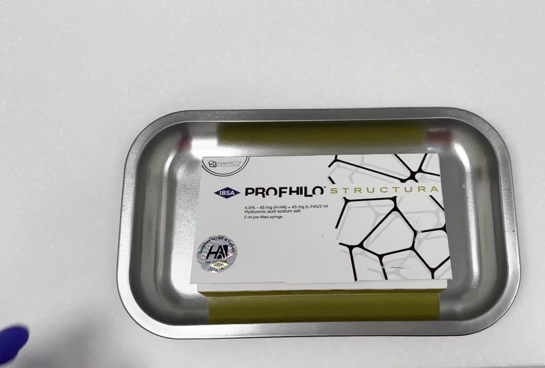 Profhilo Structura is an advanced injectable skin treatment that uses a unique form of stabilized Hyaluronic acid, specifically formulated to address the visible signs of skin aging, with a focus on issues such as skin laxity, diminished firmness, and lackluster appearance.
Treatment Focus Areas:
• Volume Depletion: Individuals often experience a reduction in facial volume and fat as they progress in age, resulting in a sunken appearance. Profhilo addresses this concern by:
• Enhancing overall skin quality and hydration
• Stimulating the production of collagen and elastin to achieve a subtle volumizing effect
• Skin Laxity: For those facing sagging skin, Profhilo effectively targets this by:
• Reinforcing skin firmness and elasticity
• Facilitating lifting and tightening of the skin without the additional volume typically associated with dermal fillers.
#prophilostructuralondon #rejuvenation #hyaluronicacid #antiaging #collagen #refresh #sinkersandsaggers