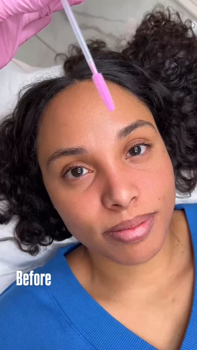 Want to know why Nano Brows has become one of my favorite techniques lately? 😍 this technique is definitely trendy right now because it’s natural results and because it causes less trauma to the skin. Hair strokes are done with a machine using a single needle creating super thin lines. This technique looks amazing on clients that have thin to medium thickness brow-hair and dry to combination skin types 😌💁🏻♀️.
Not sure if this technique is the right one for you? Schedule a FREE Zoom Consultation and let’s make your dream brows a reality! 🫶🏼🌸
.
.
.
.
#nanobrows #nanobrowsmaryland #mdnanobrows #microbladingmaryland #mdmicroblading #nanobrowsdc #dcnanobrows #mdbrows #dmvmicroblading #beforeandaftermicroblading #dcmicroblading