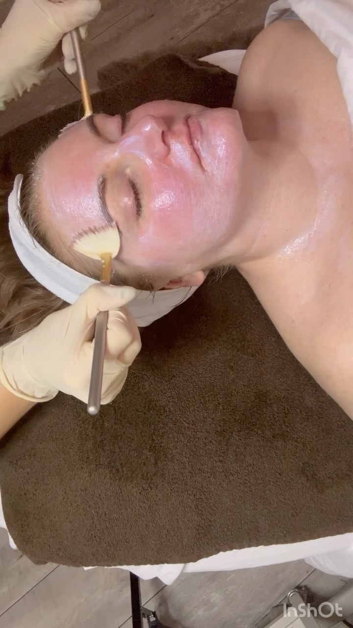 ✨ Get ready for a facial experience like no other! ✨
📍@curesbeaute is about to unveil a brand-new Sculpting Facial with a incredible technician @myftari.enxhi! Her face massage skills are a true workout for your skin, leaving you feeling blissfully rejuvenated! 💆♀️💙
🧊 The magic of this sculpting facial doesn’t stop there. Those soothing blue globes? They’re a game-changer! 🌟 They help reduce inflammation, which I know is a challenge for many.
💖 You won’t want to miss this incredible treatment at @curesbeaute ! Stay tuned for the official launch and get ready to give your face the love it deserves. 💆♂️💆♀️💆♂️ #CuresFacial #SculptingFacial #SkincareMagic #InflammationRelief
.
.
.
.
#libertyvillage #TorontoSpa #TorontoBeauty #libertyvillagespa #torontofacials #tobeauty #torontoselfcare #TorontoWellness
#spadaytoronto #TorontoSkincare
#libertyvillagewellness #torontorelaxation #gtabeauty #torontopampering
#torontoesthetics #toronto #the6ix