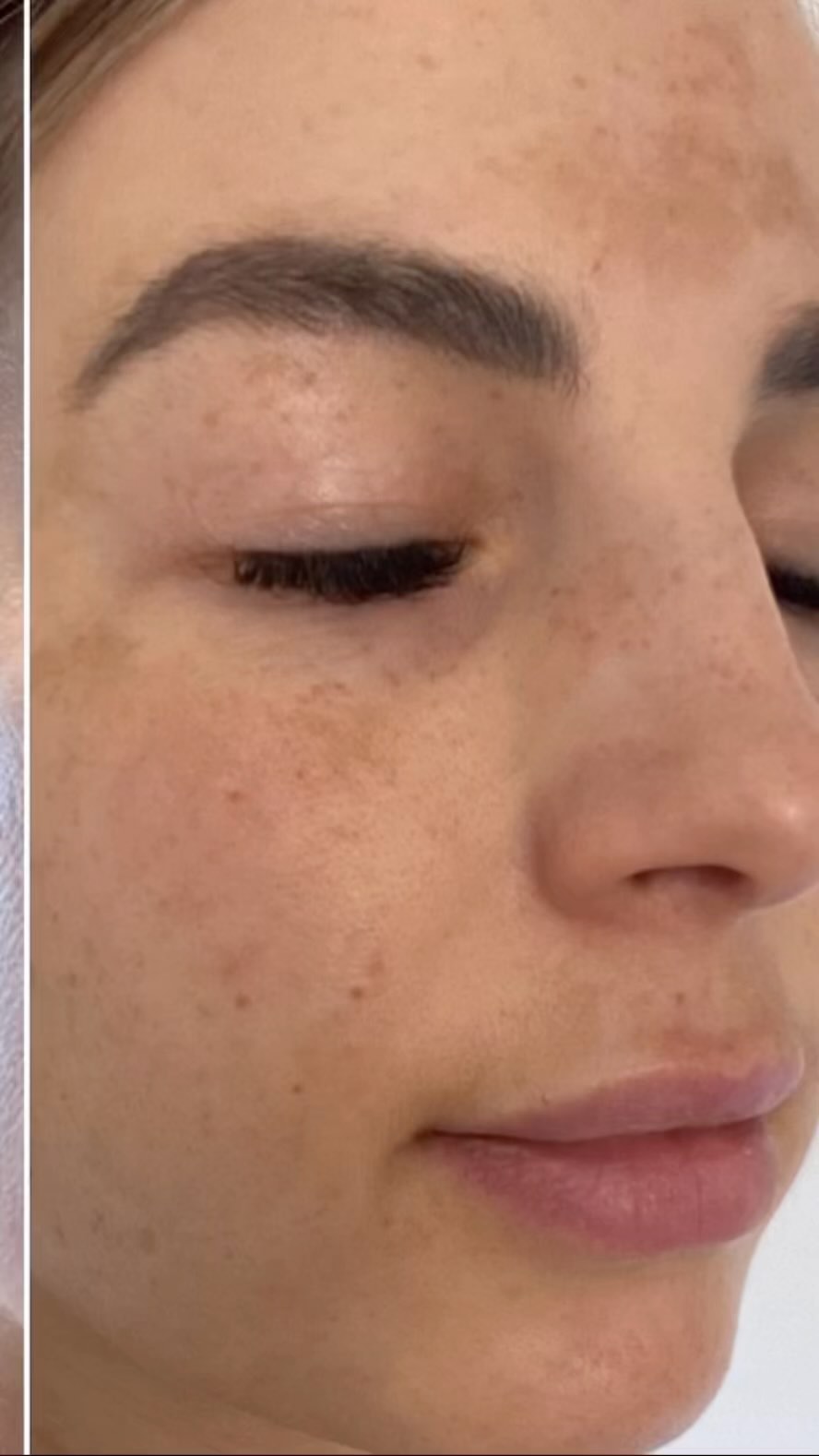 Not all journeys should be taken alone.
Our treatments and products are about results especially when you’re guided every step of the way by an Skincare Professional equipped with knowledge, beautiful science and power of skincare technology.
It’s a journey worth taking to healthy-looking beautiful skin.
#EnvironSkinCare #SkinEssentiA #microdneedling#advancednutritionprogramme#chesterfield#beautiquebarlborough#skincare