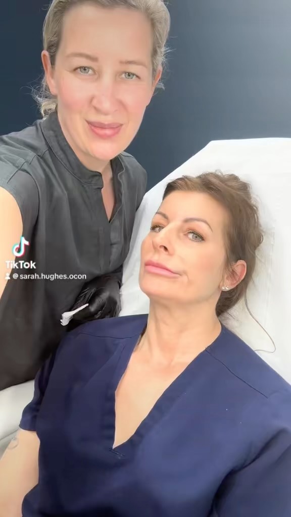 Microtoxin is botulinum toxin diluted with a skin booster. The skin booster is chosen depending on your skins needs. Here we are using a cocktail of Botox, NCTF & collagen. #microtoxin #microtox #botoxserum #nctf+ #fillmed #micrtoxnctf