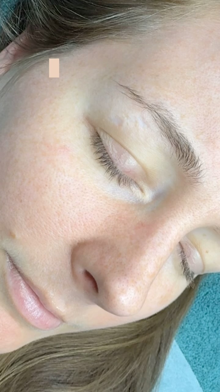 Microblading Brows by Lyly… More information ..
👉🏼www.lybrows.com
☎️703-850-0030 |. 703-992-4747
.
.
#lybrows #lybrowstudio #browsbrowsbrows #wow #pmu #permanetmakeup #makeup #tattoo #tattooartist #hairstroke #lyly #browstudio #herndon #restonva #northernvirgina