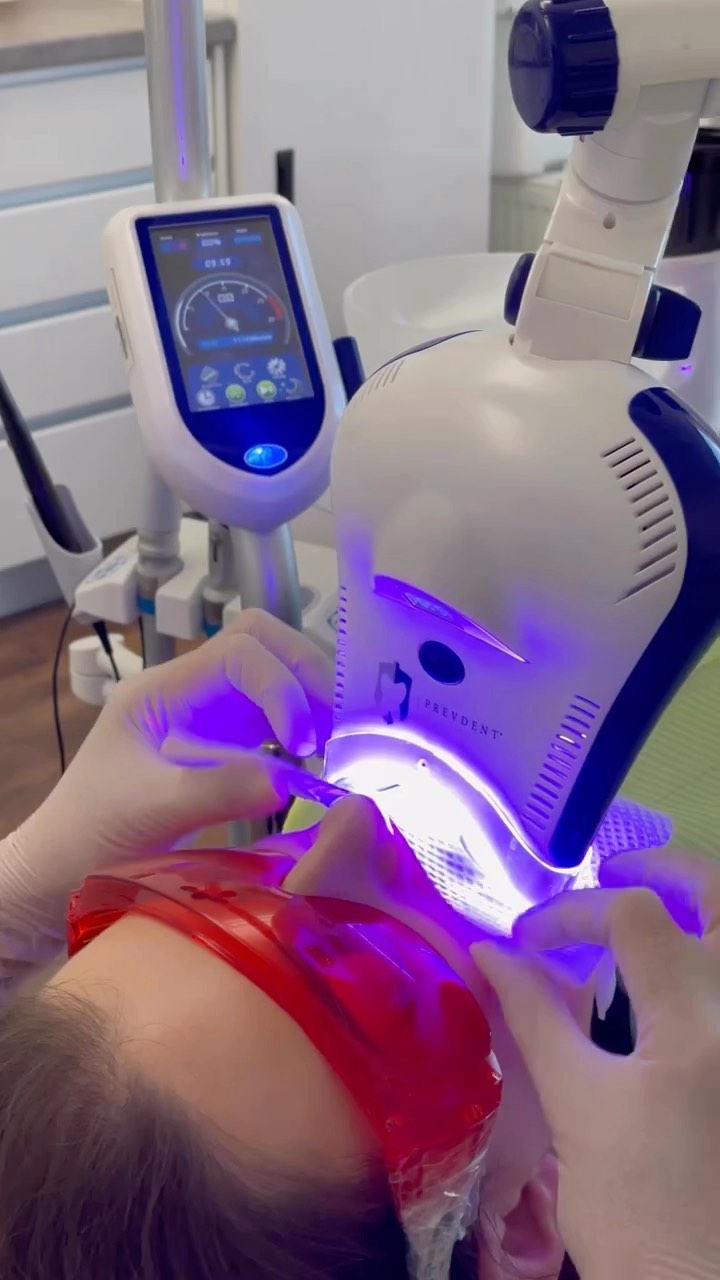 Ordinační bělení zubů #prevdent 🦷🦷🦷 #teethwhitening