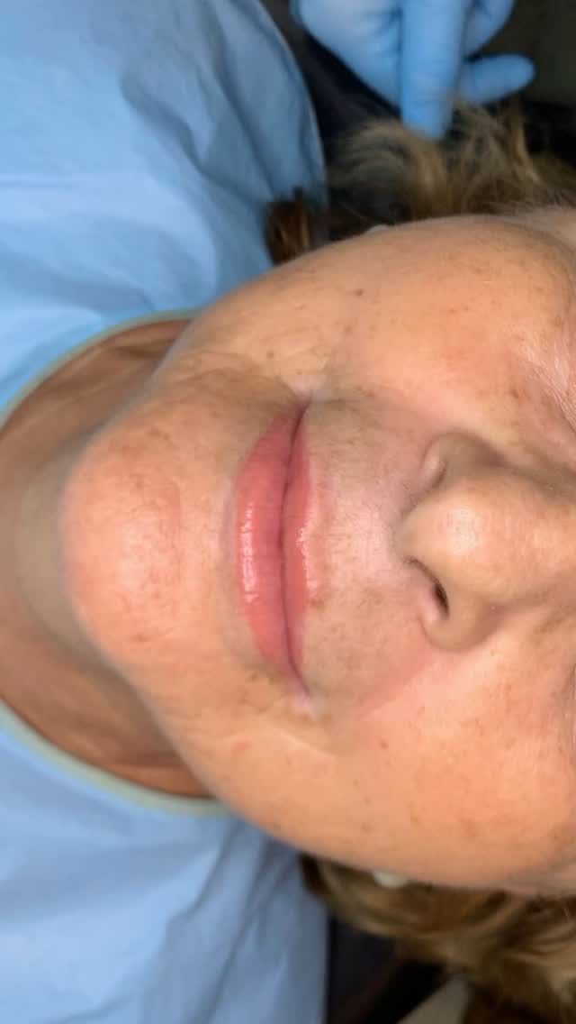 #OdontologiaEstética #Zircônia #zibase #ImplantesDentários #PróteseSobreImplante #Dentista#facetas #lentes #implantes #saudebucal #odontologia #tratamentoodontologico #dente #estetica #anapolis #implantezirconia #odontologiabiológica #odontolgiaintegral #odontologiabiologicaeintegrativa #dentistaanapolis #scannerintraoral