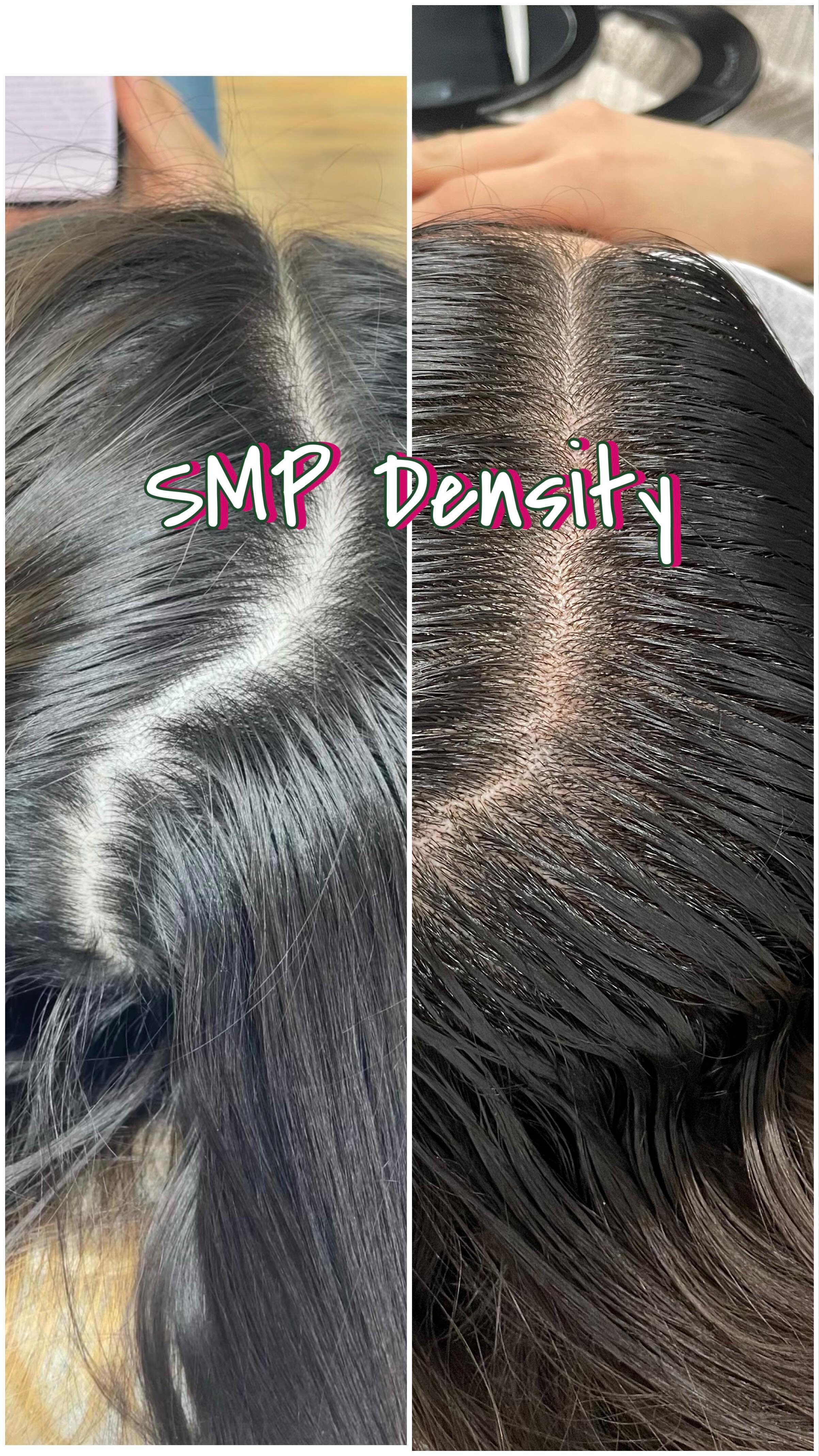 She didnโt like the sharp contrast between her scalp and hair where she parts her hair..so we did a couple SMP sessions to camouflage her part!
#smp #scalpmicropigmentation #smpindiana #indianasmp #indianahairstylist #hairrestoration