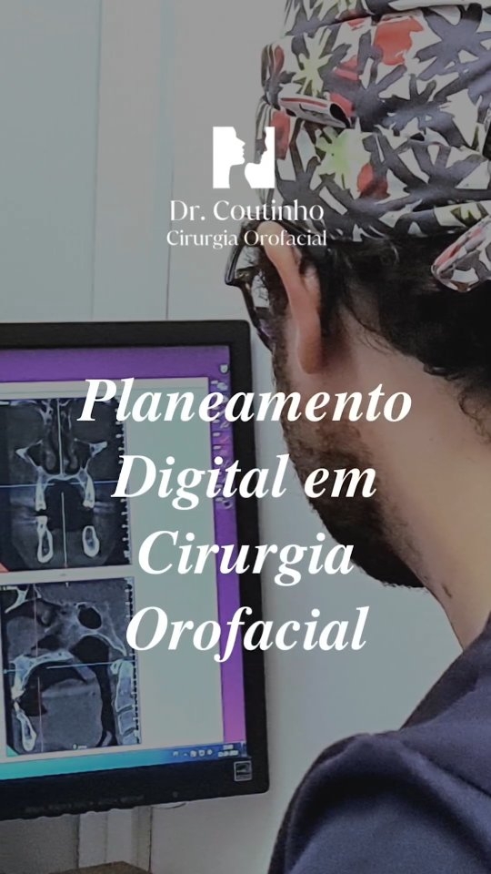 Descubra como usamos as tecnologias de visualização 3D e CAD/CAM para o planeamento digital na cirurgia orofacial:
✨ Implantes faciais customizados, projetados para se ajustar perfeitamente às necessidades anatômicas específicas de cada paciente, oferecendo uma correspondência exata para restaurar ou melhorar a estrutura facial.
🛠️ Férulas cirúrgicas usadas para guiar a reorientação dos ossos faciais, garantindo ajustes com precisão milimétrica conforme o planeamento pré-operatório.
🦷 Guias de implante dentário projetadas digitalmente para garantir que os implantes dentários sejam posicionados no ângulo e profundidade ideais, maximizando a função e a estética.
Cada uma destas técnicas de planeamento digital na cirurgia orofacial representa um avanço significativo na personalização do tratamento, precisão dos procedimentos e melhoria dos resultados para os pacientes, tanto do ponto de vista funcional quanto estético.
#TecnologiaDigital
#CirurgiaOrofacial
#InovaçãoNaSaúde