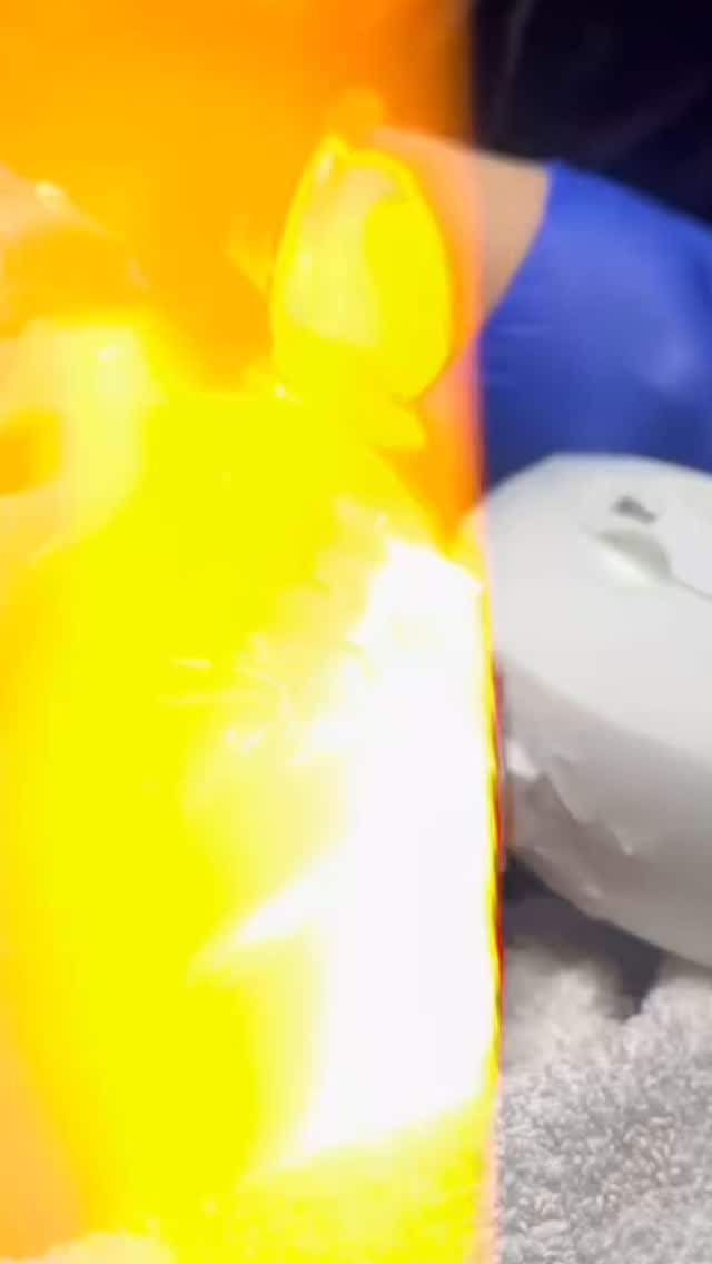 Get your summer glow on! ☀️✨ At Armin’s Beauty Affair, we’re all about helping you feel confident in your own skin — and our AOPT IPL (Advanced Optimal Pulse Technology) treatment is your new best friend for smooth, radiant, and rejuvenated skin.
This non-invasive treatment targets pigmentation, sun damage, redness, and uneven skin tone, giving you that natural, lit-from-within glow — just in time for summer vibes! 🌼 Whether you’re heading to the beach or brunch, your skin will look flawless and fresh.
Say goodbye to dullness and hello to luminous, healthier skin! 💛
📍 Book your glow session now and let your skin shine all season long!
#GlowingSkin #SummerSkinGoals #IPLGlow #AOPTIPL #ArminsBeautyAffair #HalifaxBeauty #SkinConfidence #RadiantSkin #GlowUpSeason #BeautyClinic #NonInvasiveTreatment #HealthySkinJourney #SkincareThatWorks #SunReadySkin #HydrateAndGlow #skinlove