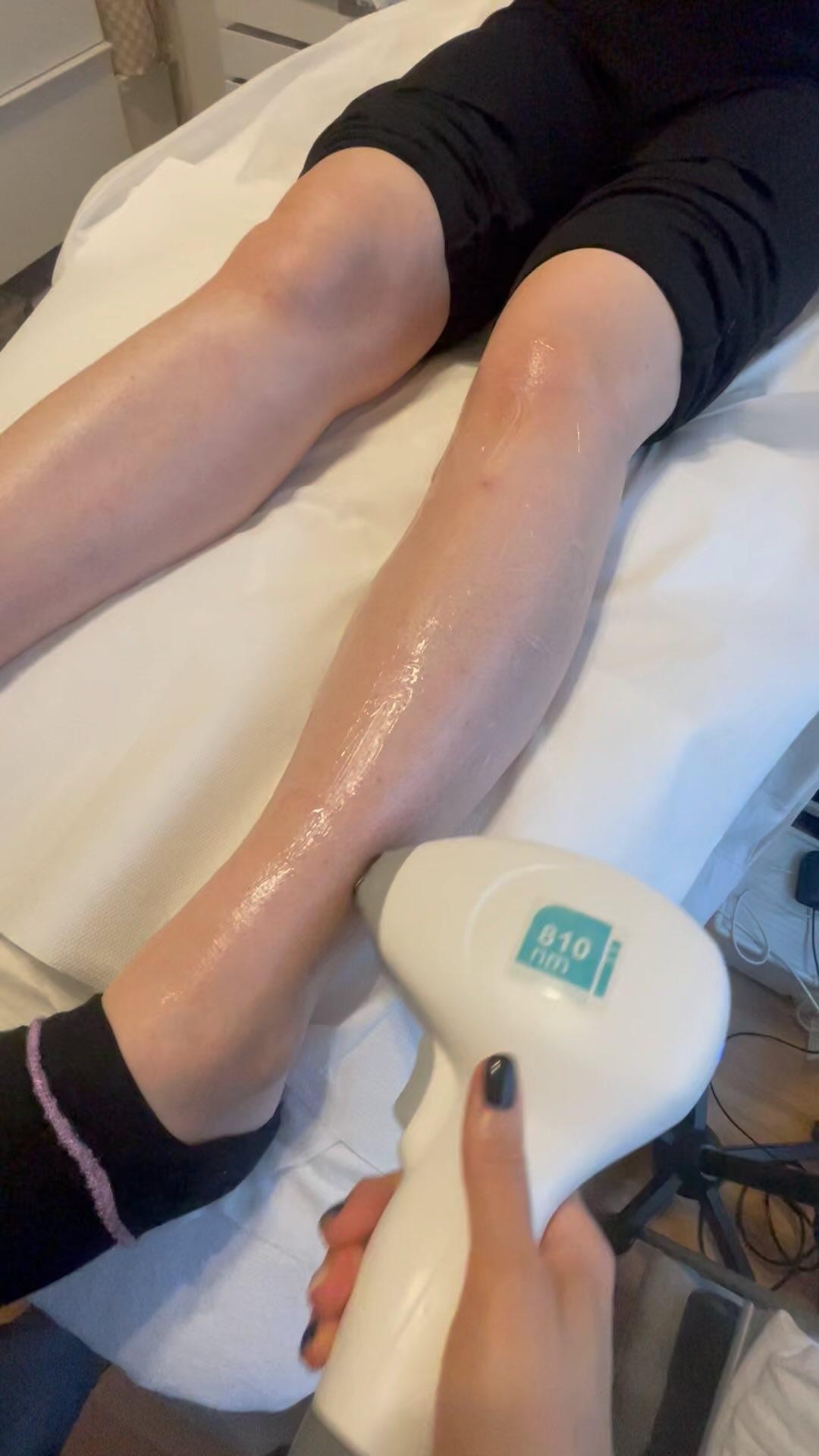 #elysionpro #elysion #best #byebyehair #fashionbeauty #cosmetics @melindapoznik