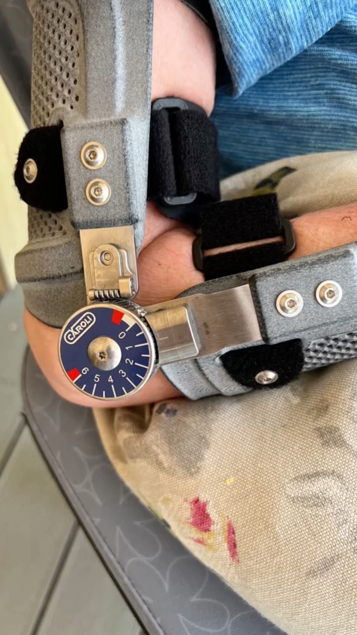 Werkstücke der Woche (zumindest ein Ausschnitt davon 😃🙈) nun kann der Urlaub beginnen 🥰
🇬🇧 Work of the week done ✅ vacation mode on ☺️
•
•
#orthopädietechnik
#oandp #prosthetictechnician #prosthetic #belowkneprosthesis #prostheticleg #orthosis #orthotics #orthese #handmade #handmadewithlove #handcrafted #handwerk #handwerkskunst #handwerksstolz #lustaufhandwerk #meinhandwerkhilft