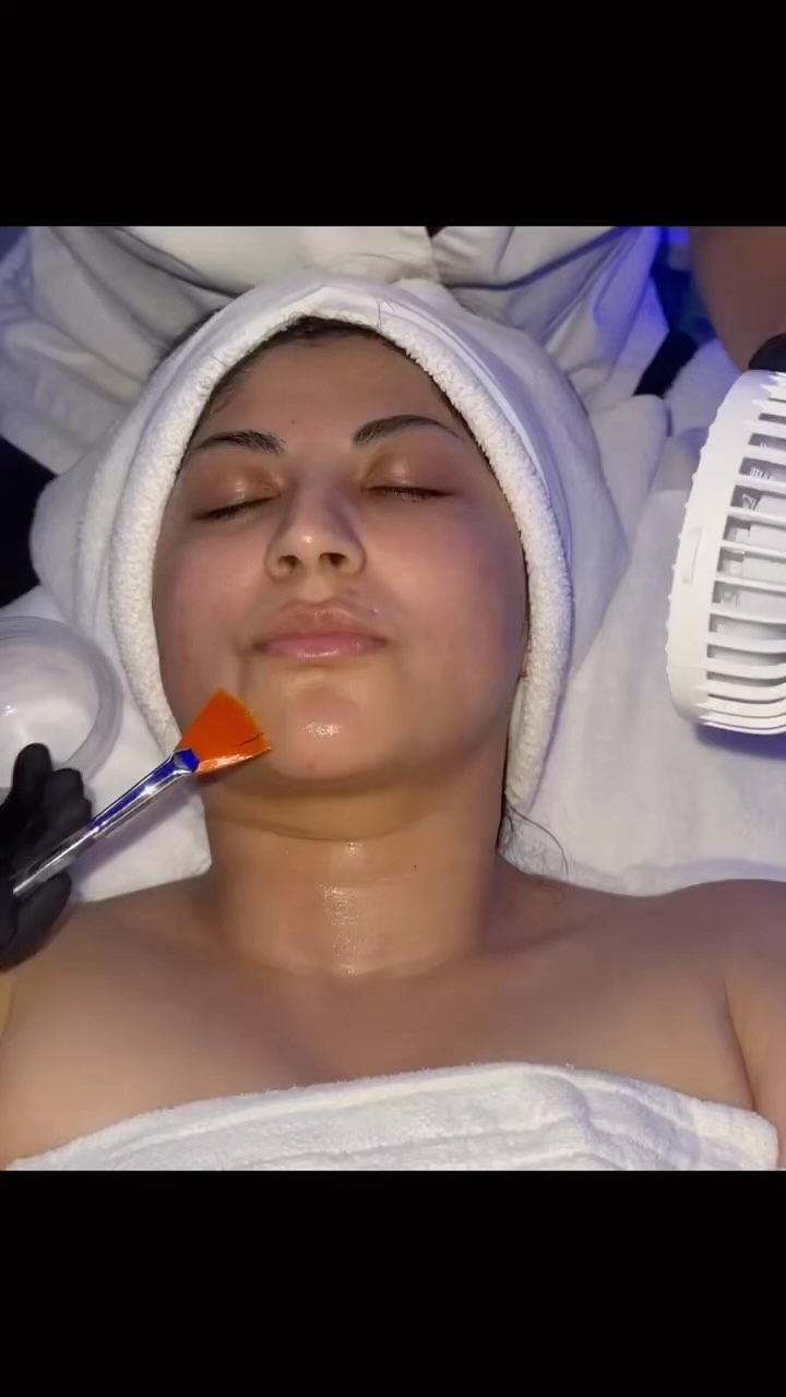 Nano Needling with Gua
Sha. Nano needling creates tiny channels in the epidermal (top) laver of skin to penetrate select serums. Targeting fine lines, wrinkles, reducing pigmentation and large pores. Gua Sha is an ancient Chinese practice used for lymphatic drainage,smoothing fine lines and wrinkles, reducing puffiness, contouring, and penetrating product.
Visit beautifulfacials.com
#lymphaticdrainage#fa cials #carlsbad #skinforlife #dermodality #guashafacial