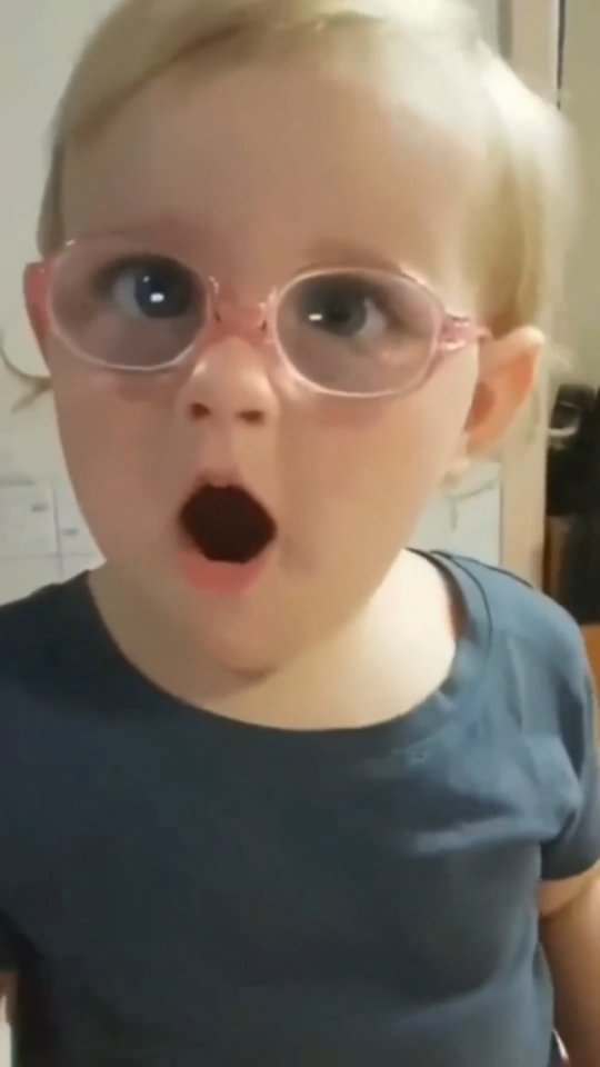 Emocionante esse vídeo ❤️
Lembrando a importância do exame oftalmológico na criança.
👉🏼Indicado como rotina a partir do primeiro ano de vida.
🔺Em alguns casos de suspeita de estrabismo, prematuridade, infecções congênitas ou alterações no reflexo ocular vermelho a avaliação deve ser mais precoce.
@eyekidsoftalmopediatria @oftalmopediatriaemcasa @oftalmopeddrasimone