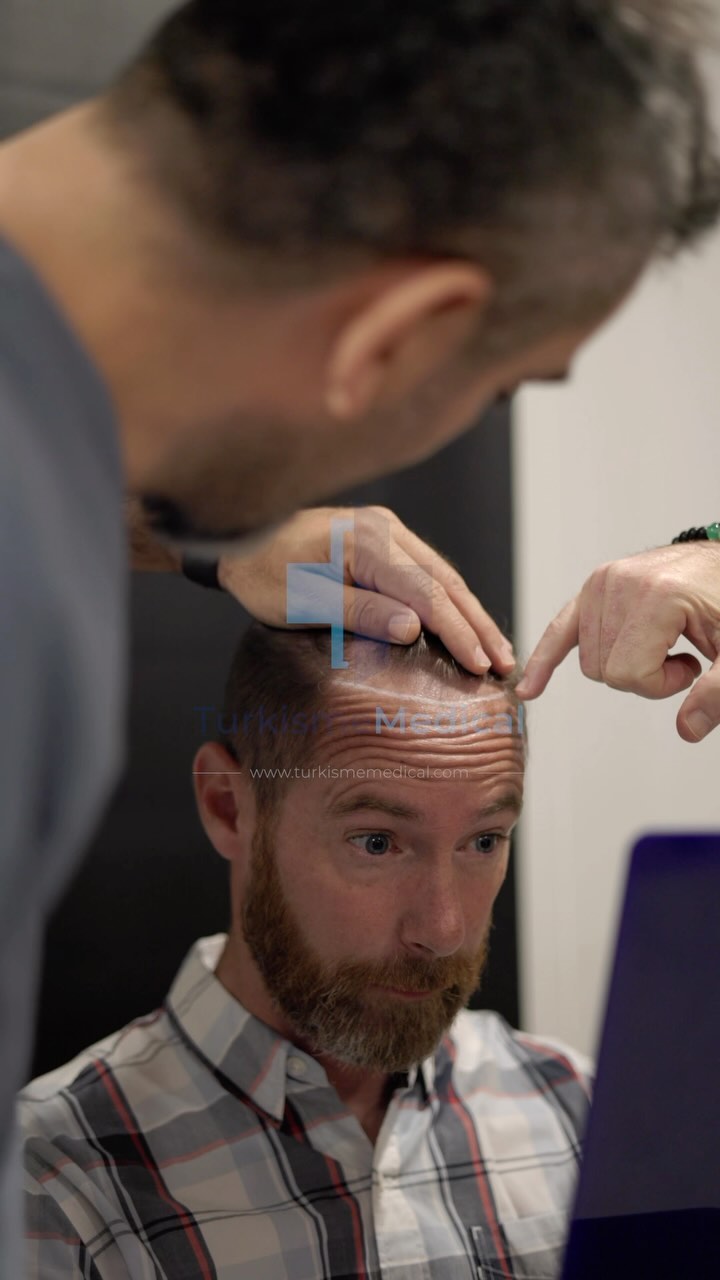 Expert Personal Guidance in French with Exceptional Ongoing Support for your Hair Transplant journey with Turkisme Medical.
#greffedecheveux #greffedecheveuxturquie #alopecia #biotin #hairtransplant