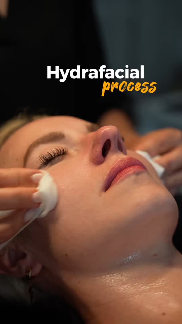 Glowing skin starts here!🌞
Hydrafacial is not just a facial — it’s a deep cleansing, hydrating, and rejuvenating treatment your skin will thank you for.
Perfect for all skin types, zero downtime, and instant results.
Clear. Glow. Repeat.
Book your Hydrafacial at LNO Boutique today!
Link in bio.
Filming by @lily.filmmaker
#HydrafacialGlow
#LNOspa
#GlowingSkin
#HydrafacialLove
#SkincareRoutine
#FacialTreatment
#SpaDayVibes
#SkinGoals
#ColoradoSkinCare
#SelfCareTime
#lno_boutique
#facial
#DenverSpa
#CentennialSpa