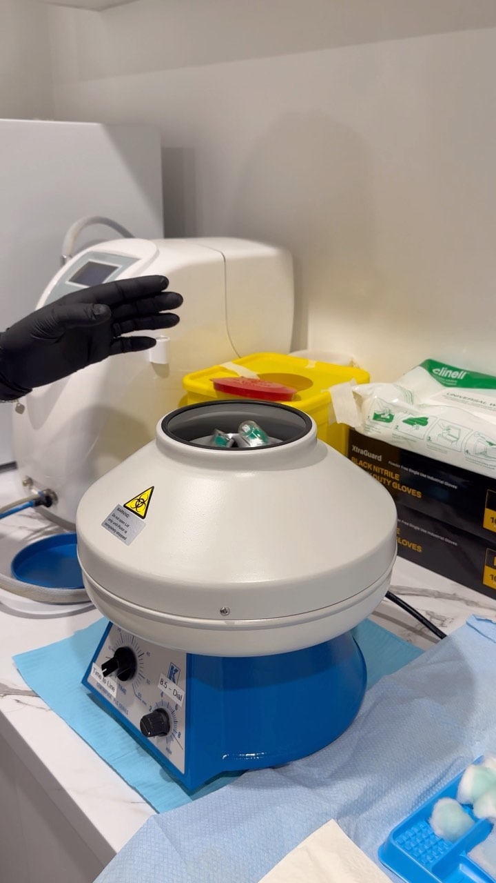 A day full of PRP β¨ππ§¬π©΅
β’
β’
#prpsunshinecoast #prpfacial #prptreatment #prptedavisi #prpinjection #prphair #prphairrestoration #prptherapy #prpinjections #plateletrichplasma #plateletrichfibrin #urbanlistsc