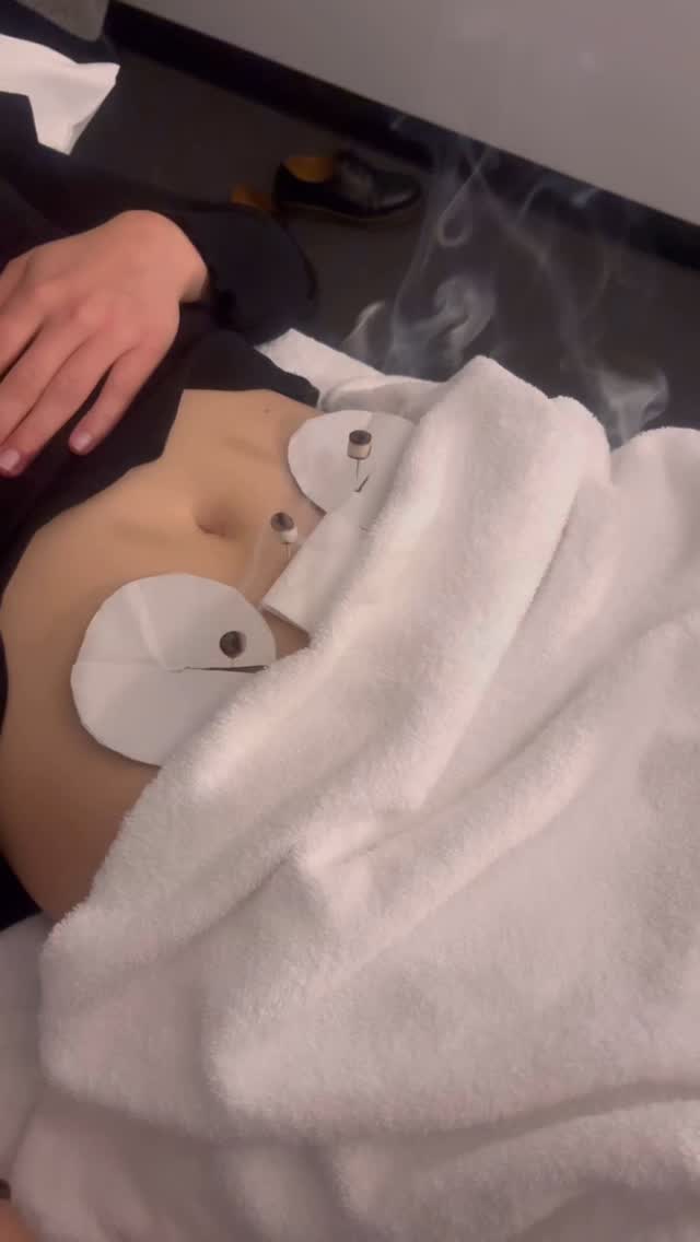 Why I love Moxa Therapy for Digestion & Period Imbalances 🔥
Moxa (or moxibustion) is a deeply warming Traditional Chinese Medicine technique that uses mugwort to gently stimulate acupuncture points and meridians.
When used over the abdomen, it’s incredible for:
✨ Boosting digestive fire – helping with bloating, sluggish bowels, and poor appetite
✨ Warming the uterus – easing period pain, irregular cycles, and cold-induced cramps
✨ Supporting Qi and Blood flow – essential for hormonal balance and menstrual regularity
This gentle heat therapy is especially helpful if you tend to feel cold, fatigued, or struggle with low energy and PMS.
#moxatherapy #digestionhelp #periodbalance #tcmhealing #womenshealth #hormonehealth #wombwellness #acupuncturelife #guthealthsupport #naturalhealing #mugwortmagic #cyclehealth #holisticliving #warmingtherapy #qiandbloodflow