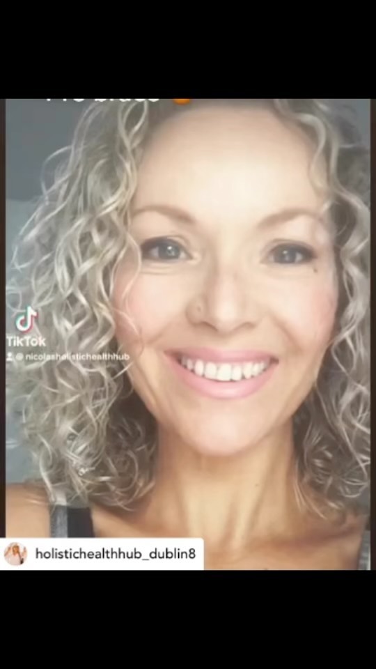 We are thrilled to see our patients sharing their inspiring smile journeys. Hard work always pays off 💪👌🙌 Thank you Nicola @holistichealthhub_dublin8 for trusting your smile to us
#dublinorthodontist #smilemore #drkostas #dublinbraces #orthodontics #orthodontist #midlinecorrection #smilejourney #dublin #beforeandafter #braces #teethstraightening #damonbraces #smiletransformation