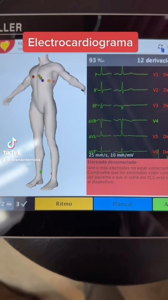 ♥️ Electrocardiograma (arritmias, alteraciones del corazón)
Se realiza para:
✅ Check-up médicos >40 años
✅ Valoración pre-operatoria
✅ Palpitaciones, dolor de pecho, falta de aire.