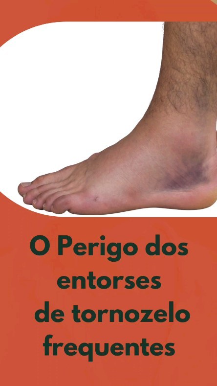 Entorses de tornozelo recorrentes? Perigo.... entenda e se cuide.
.
.
.
.
.
#terapiamanual #vilamariana #osteopatia #osteopatiasp #trauma #liberaçãomiofascial #fisioterapiasp #ipiranga #entorses #ortopedia #fisioortopedica #tornozelo #pé #corrida #caminhada