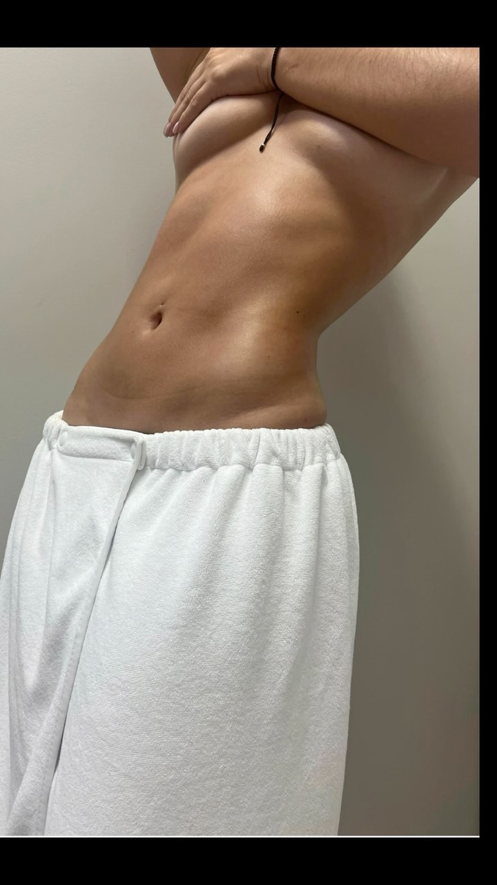 🌱 Our Post Op Care Treatment is made for those who have gotten surgery. The most beneficial period to get in the first month post surgery. Although this treatment can benefit anyone at any stage of their recovery.
•
•
📲 (786)506-4371. ✔️Booking now.