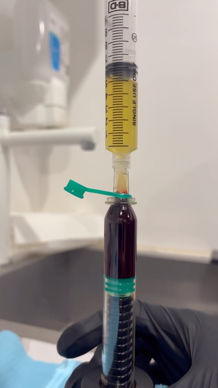 A trailer to your PRP appointment β¨π©΅π§¬ #prp #prpappointment #prphair #prpskin #urbanlistsc