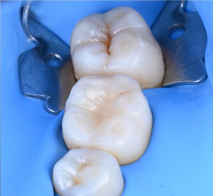 Wait for the result :)
#highendcomposites #shotwithfixlite