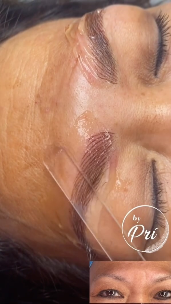 Mary has NO MORE STRUGGLE having to do her brows in the mornings 🥰 Now she has Digital Microblading aka Nano Hairs Strokes Brows — Call Now to book yours ☎️ +1 (772) 999-4443
👉Eyebrow Microblading by Prí
📩 51 Royal Palm Pointe
📫Vero Beach, FL
•⭐️⭐️⭐️⭐️⭐️
•💥New brows!
•
•
#verobeach #microbladingverobeach #@DigitalMicroblading #microbladingsebastian #sebastian #microbladingorchidisland #orchidisland #Microbladingdfortpierce #fortpierce #microblading #eyebrows #MicrobladinNano #microbladingportstlucie #stlucie #eyebrowmicroblading #eyebrowtattoo #eyebrowshaping #microbladingartist #eyebrowsonfleek #pmubrows #pmuartist #micropigmentation #micropigmentacao #sobrancwlhafioafio #micropigmentadora #microbladingfioafio #sobrancelhasfioafio3d #eyebrowMicrobladingbypri
#Eyebrowmicrobladingbypri #(772)999-4443