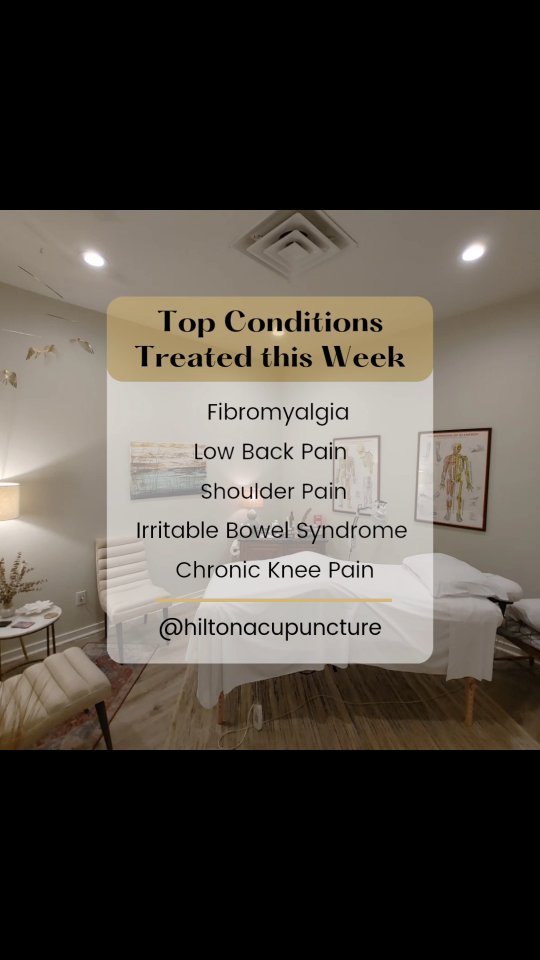 What can we help you with? π Give us a call to schedule a consultation. βοΈ
#hiltonacupuncture #acupuncture #tcm #acupunctureworks #mountpleasant