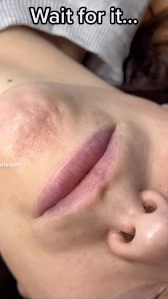 Lipblush coverup💖
@phiacademy_schora
@branko_babic_phiacademy @permablend_pigments @evenflocolours @ayaahassanii
#lipblush #lippigmentation #pmulips #pmu #lippigmentatie #colorlips #permanentmakeup #permablend #permanetcolors #permablendlips #groningen #happycustomer #phicontourlips #phicontour #poppinglips #neutralizing #phiacademy