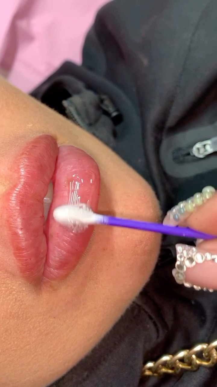 Take advantage of my Black Friday sale 🖤🏷 booking link in bio. #lashextensions #lashes #lipfillers #lipfillertraining #hyaluronpen #hyaluronpenusa #tampalips #bradentonlips #sarasotalips #stpetelipfiller #nails #russianlips #lipfillerbeforeandafter #hairinspo #makeuptutorial #hairtutorial