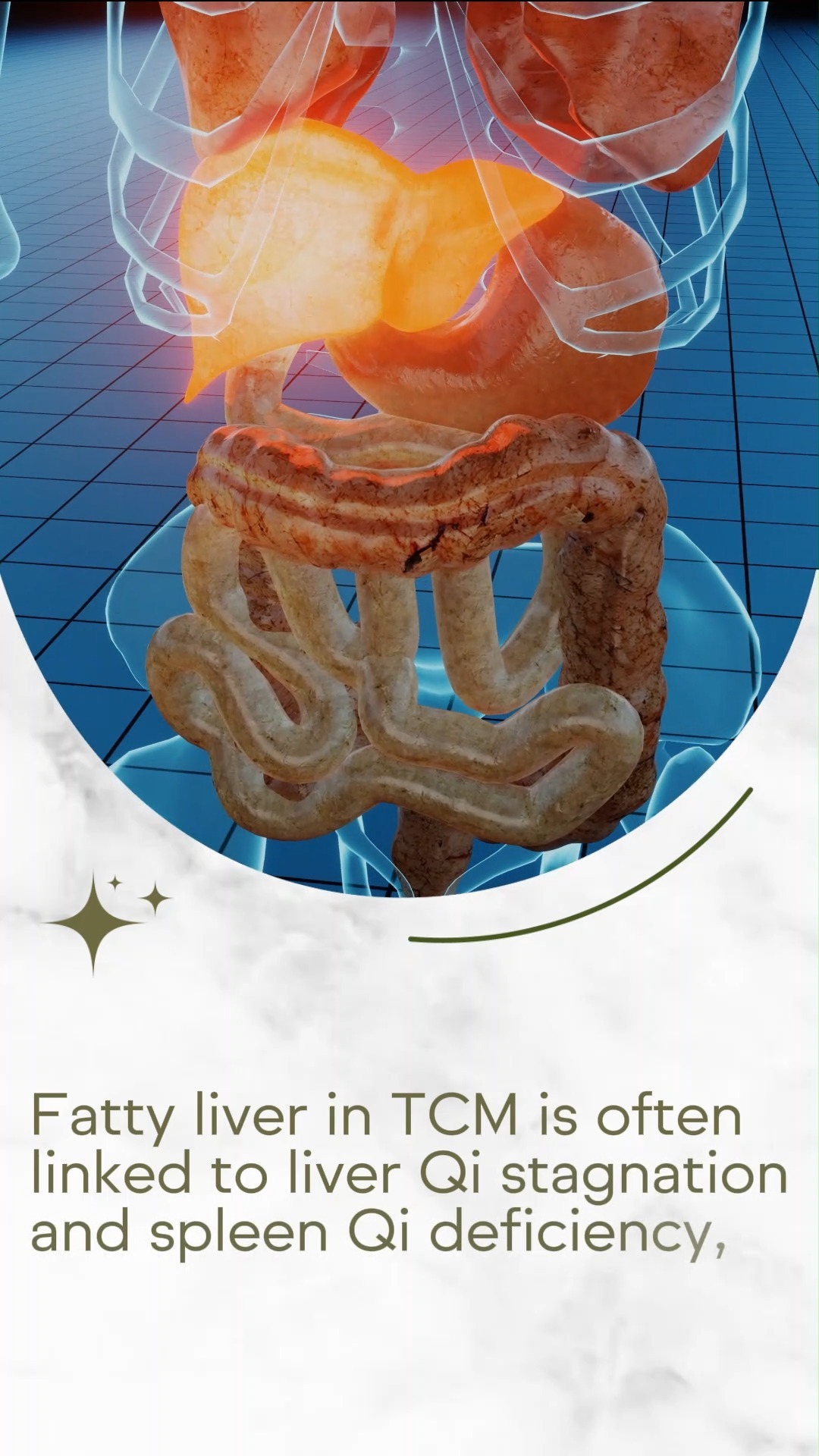 Fatty liver in TCM is often tied to liver Qi stagnation and spleen Qi deficiency, leading to dampness and fat buildup. Symptoms like fatigue, abdominal discomfort, and jaundice are early signs. With targeted herbal remedies and acupuncture, TCM addresses these imbalances and promotes liver health. Early care is essential to prevent progression and support long-term wellness.
📍 Visit us at One Commonwealth, Commonwealth Lane, Singapore
💻 Schedule your consultation now: www.htmplsg.com
#FattyLiver #TCMHealing #LiverHealth #Acupuncture #HerbalRemedies #TCMSingapore #Detox #HolisticHealth #WellnessJourney #TraditionalChineseMedicine